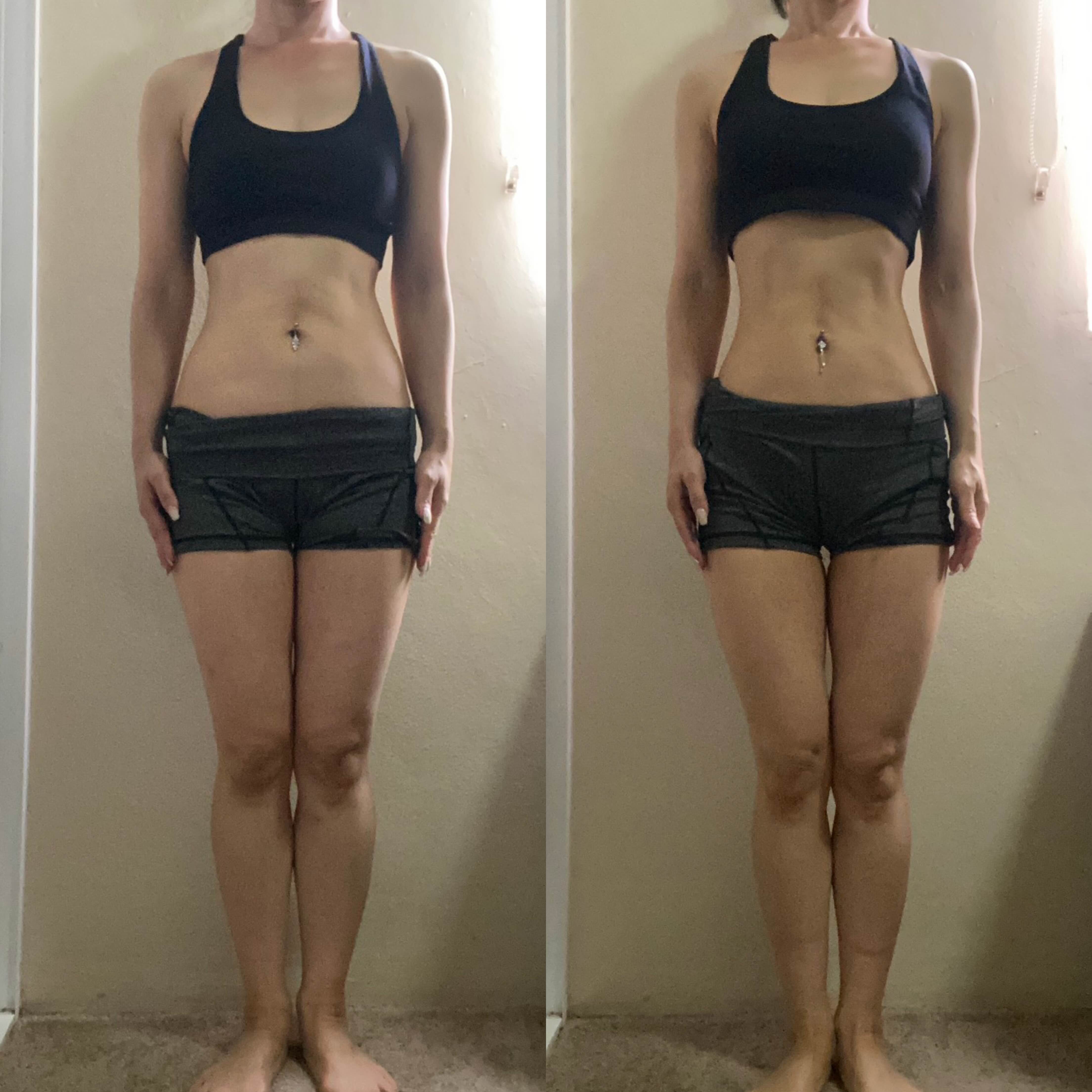 M様のビフォーアフター