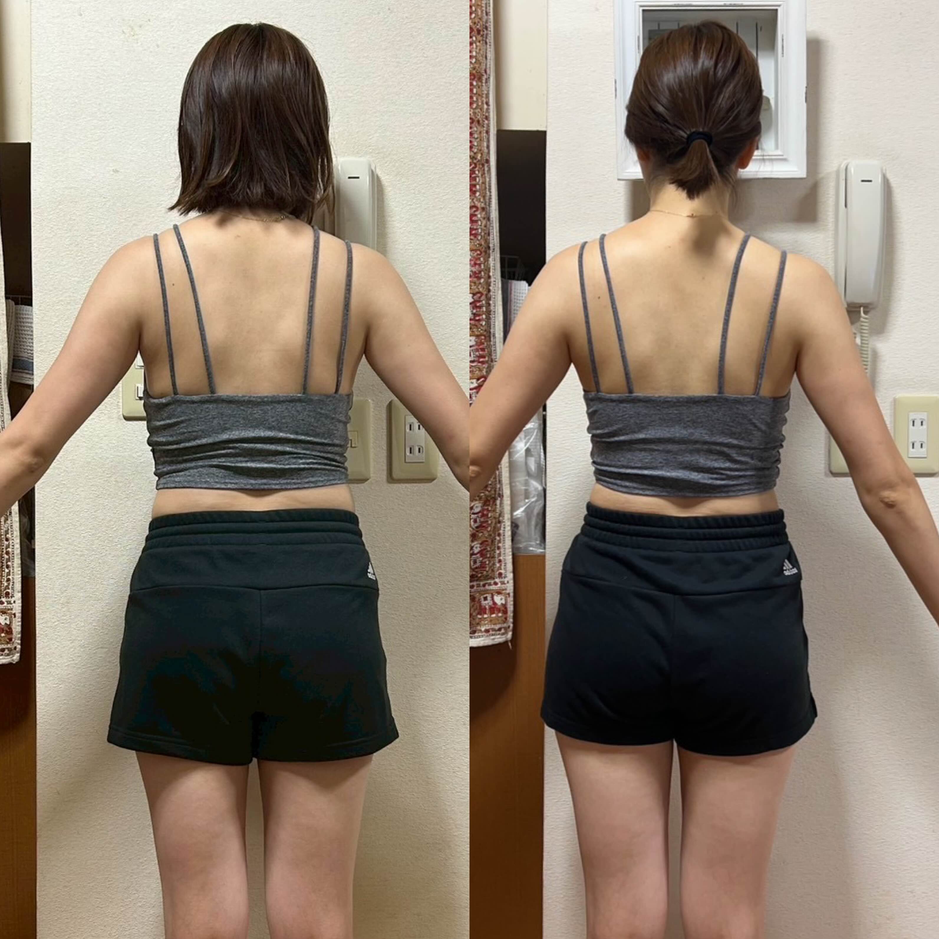 S様のビフォーアフター