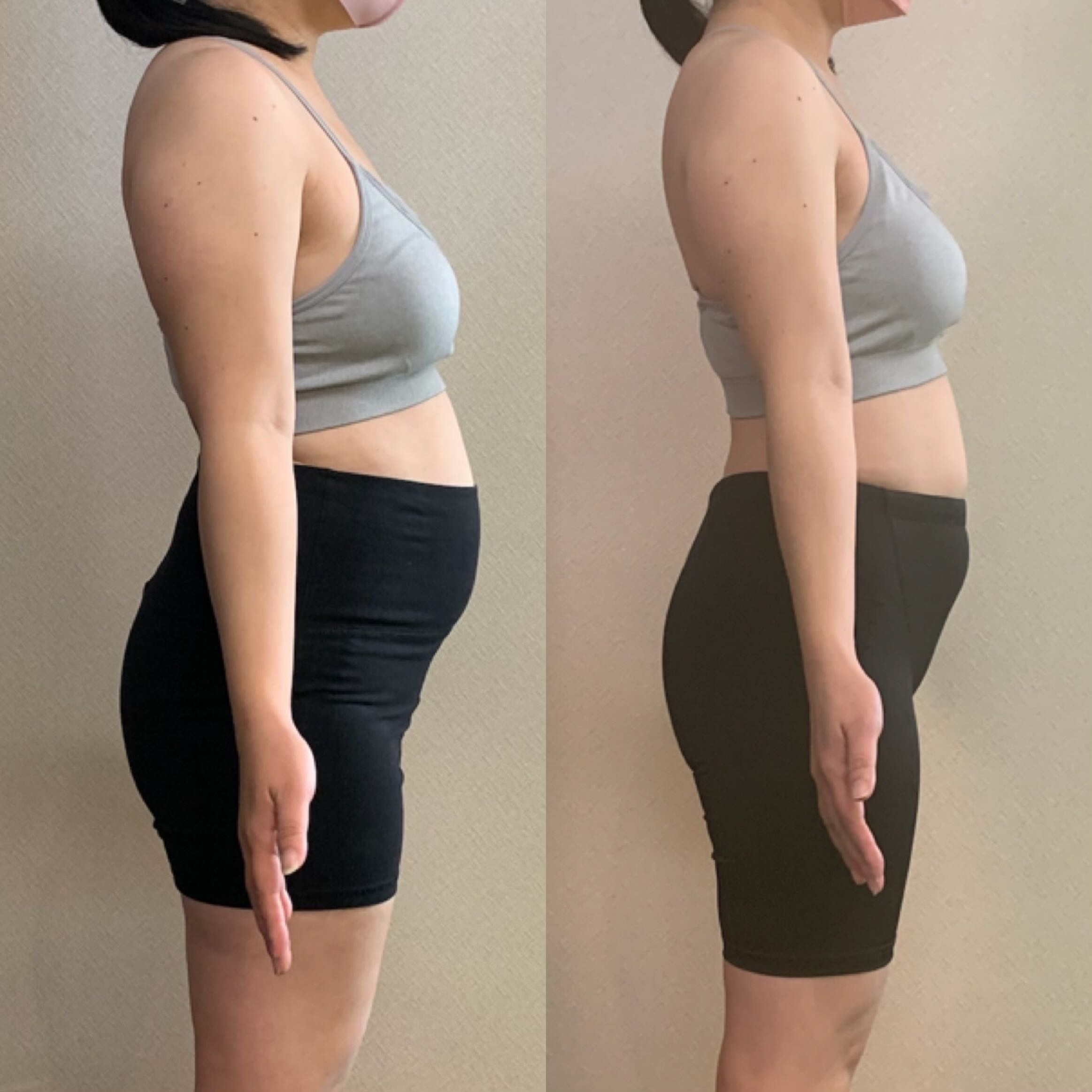 M様のビフォーアフター